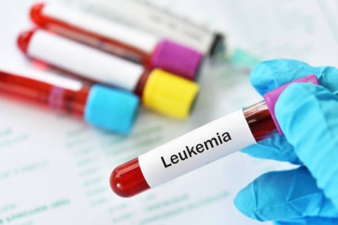 neonatal leukemia